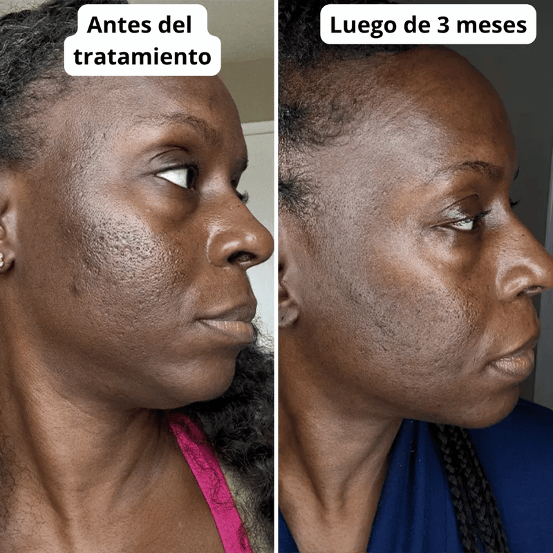 Transformación de cliente