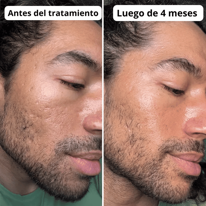 Transformación de cliente