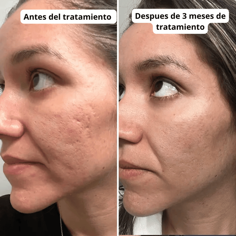 Transformación de cliente