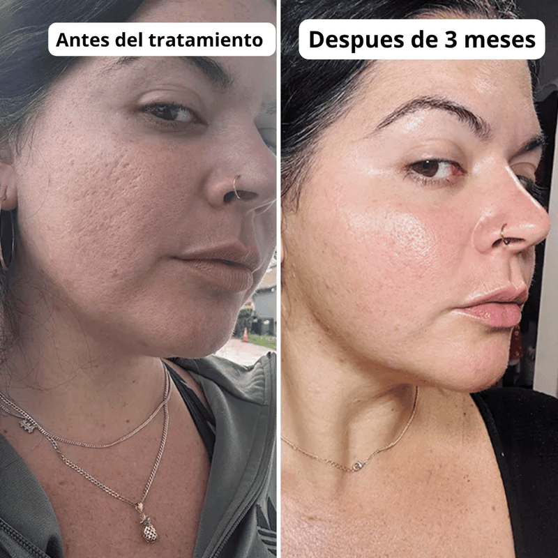 Transformación de cliente