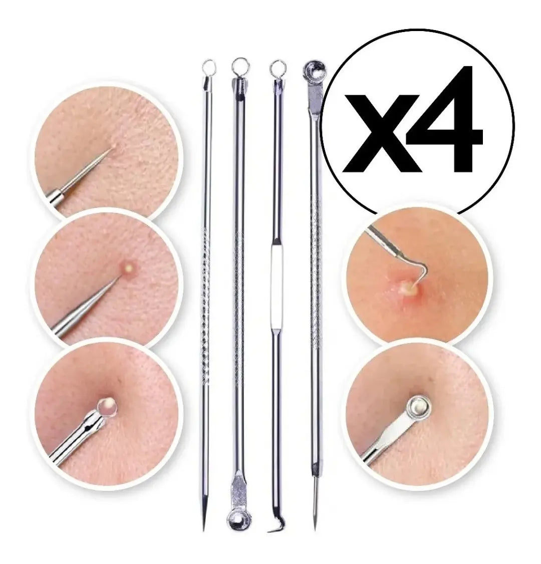 Kit Extractor Puntos Negros Y Granitos